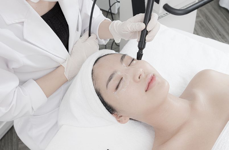 Điều trị mụn bằng phương pháp vi kim: Giải pháp làm đẹp hiện đại