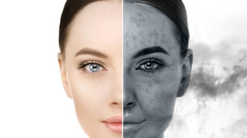 Chăm sóc da mụn trong môi trường ô nhiễm